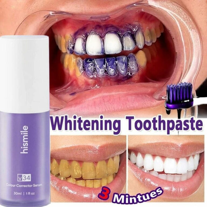 Hismile v34 Color Corrector Serum | Instant Teeth Brightening Solution | 30ml - My Store